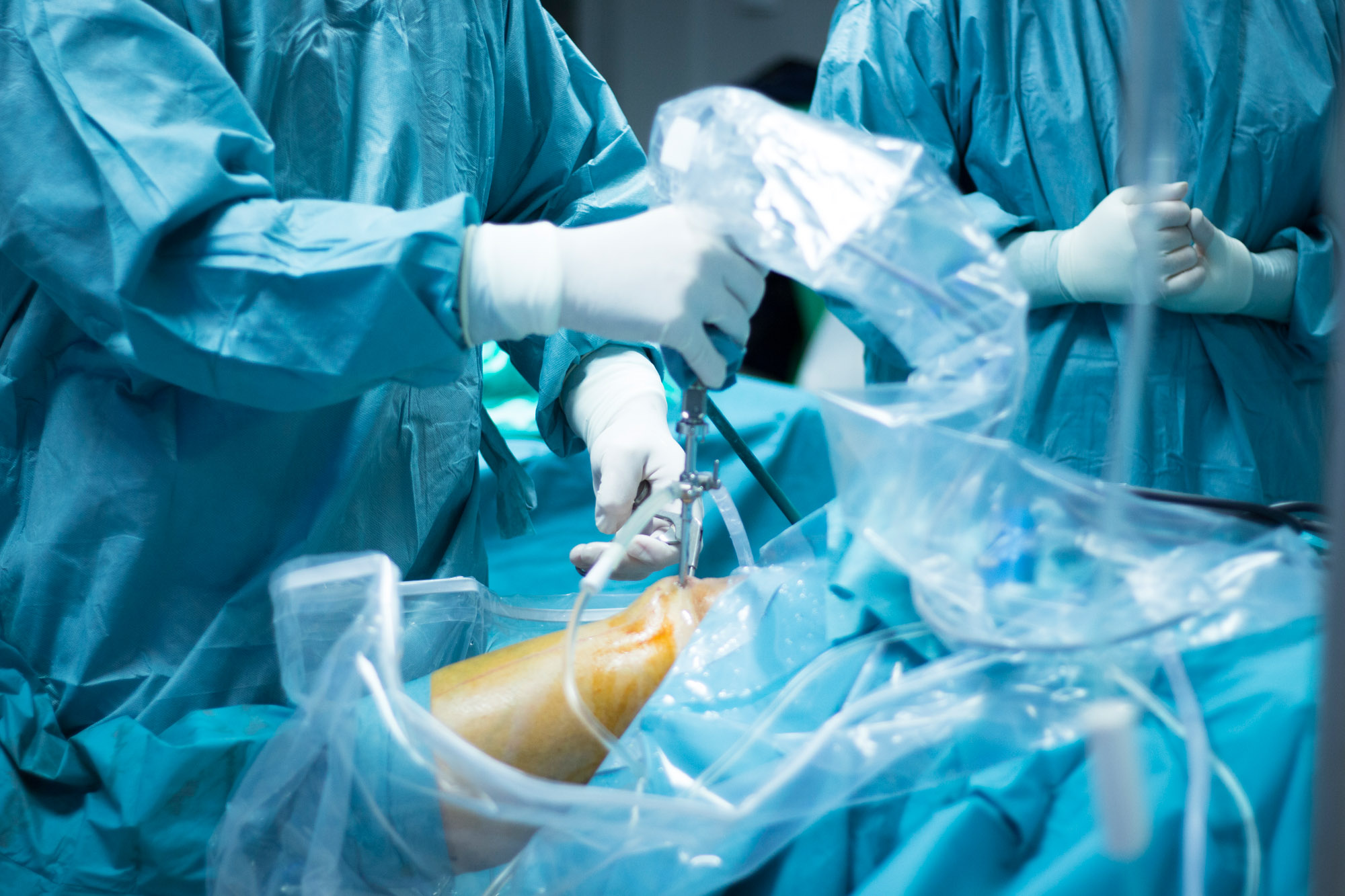 ACL Reconstruction - Dr Sunil Reddy - Orthopaedics Adelaide